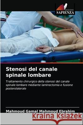 Stenosi del canale spinale lombare Mahmoud Gama 9786203544992 Edizioni Sapienza - książka