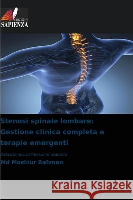 Stenosi spinale lombare: Gestione clinica completa e terapie emergenti Rahman, Md Moshiur 9786208498672 Edizioni Sapienza - książka