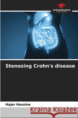 Stenosing Crohn's disease Hassine, Hajer 9786209470981 Our Knowledge Publishing - książka