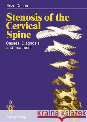 Stenosis of the Cervical Spine: Causes, Diagnosis and Treatment Denaro, Vincenzo 9783642762055 Springer - książka
