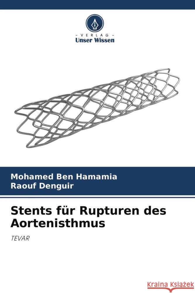 Stents für Rupturen des Aortenisthmus Ben Hamamia, Mohamed, Denguir, Raouf 9786204313719 Verlag Unser Wissen - książka