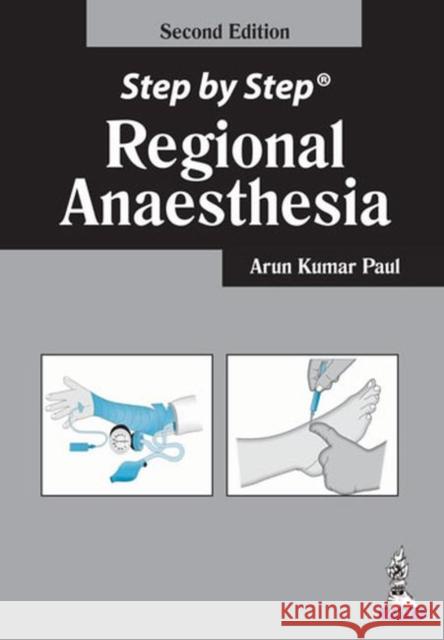 Step by Step: Regional Anaesthesia Paul Arun Kumar 9789351520771 JP Medical Publishers (ML) - książka