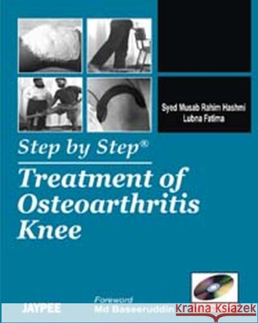 Step by Step: Treatment of Osteoarthritis Knee Syed Musab Hashmi   9789380704838 Jaypee Brothers Medical Publishers - książka