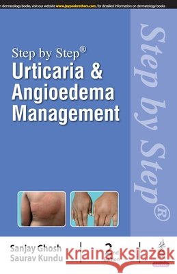 Step by Step: Urticaria & Angioedema Management Sanjay Ghosh, Saurav Kundu 9789356969827 Jaypee Brothers Medical Publishers - książka