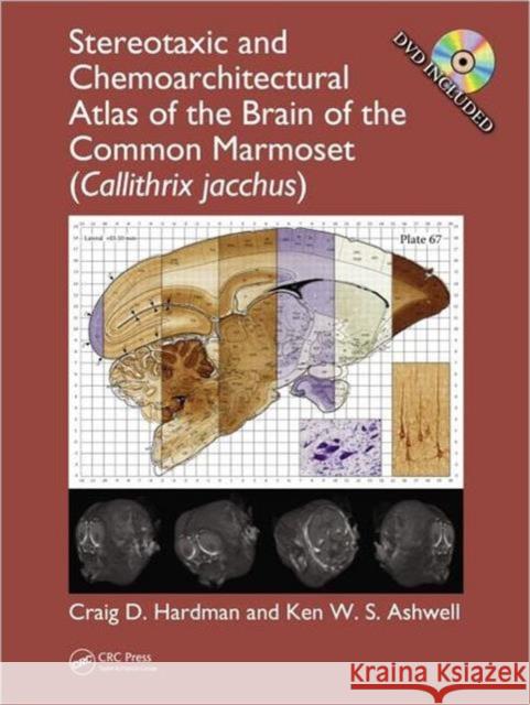 Stereotaxic and Chemoarchitectural Atlas of the Brain of the Common Marmoset (Callithrix Jacchus) Hardman, Craig D. 9781439837788  - książka