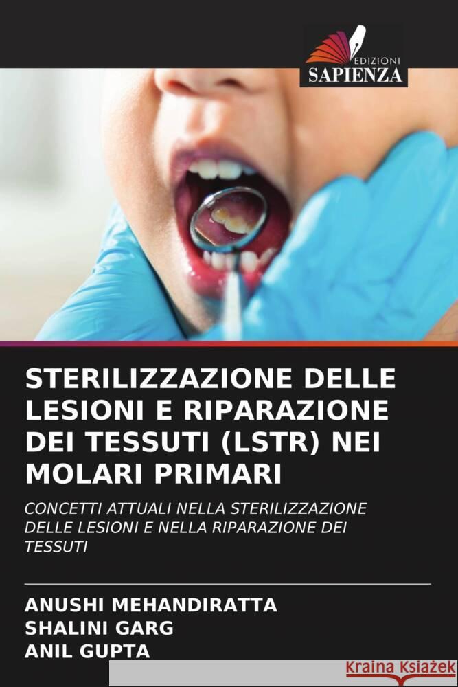 Sterilizzazione Delle Lesioni E Riparazione Dei Tessuti (Lstr) Nei Molari Primari Anushi Mehandiratta Shalini Garg Anil Gupta 9786208062767 Edizioni Sapienza - książka