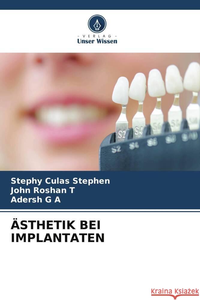 ÄSTHETIK BEI IMPLANTATEN Stephen, Stephy Culas, Roshan T, John, G A, Adersh 9786208190064 Verlag Unser Wissen - książka