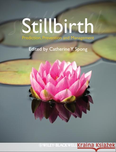 Stillbirth: Prediction, Prevention and Management Spong, Catherine Y. 9781444337068  - książka