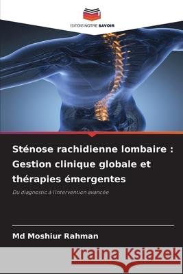 Sténose rachidienne lombaire : Gestion clinique globale et thérapies émergentes Rahman, Md Moshiur 9786208496111 Editions Notre Savoir - książka