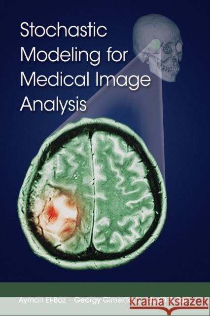 Stochastic Modeling for Medical Image Analysis Ayman El-Baz Georgy Gimel'farb Jasjit S. Suri 9781032237541 CRC Press - książka