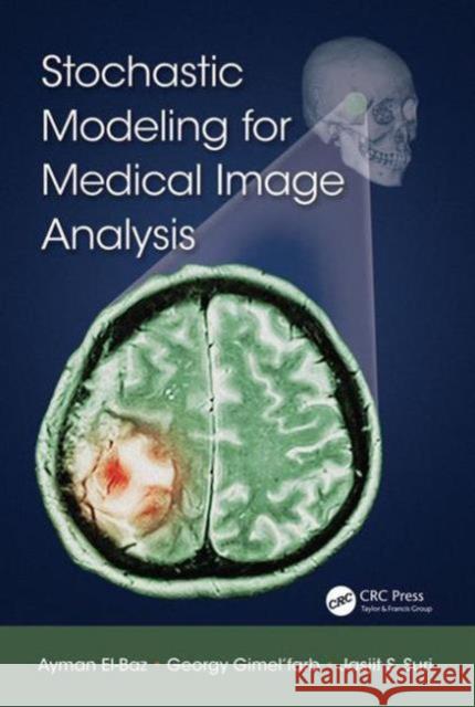 Stochastic Modeling for Medical Image Analysis Ayman El-Baz Georgy Gime Jasjit S., Ed. Suri 9781466599079 CRC Press - książka