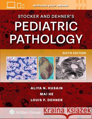 Stocker and Dehner's Pediatric Pathology Aliya Noor Husain Louis P. Dehner Mai He 9781975244071 LWW - książka