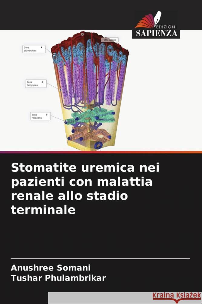 Stomatite uremica nei pazienti con malattia renale allo stadio terminale Anushree Somani Tushar Phulambrikar 9786207336890 Edizioni Sapienza - książka