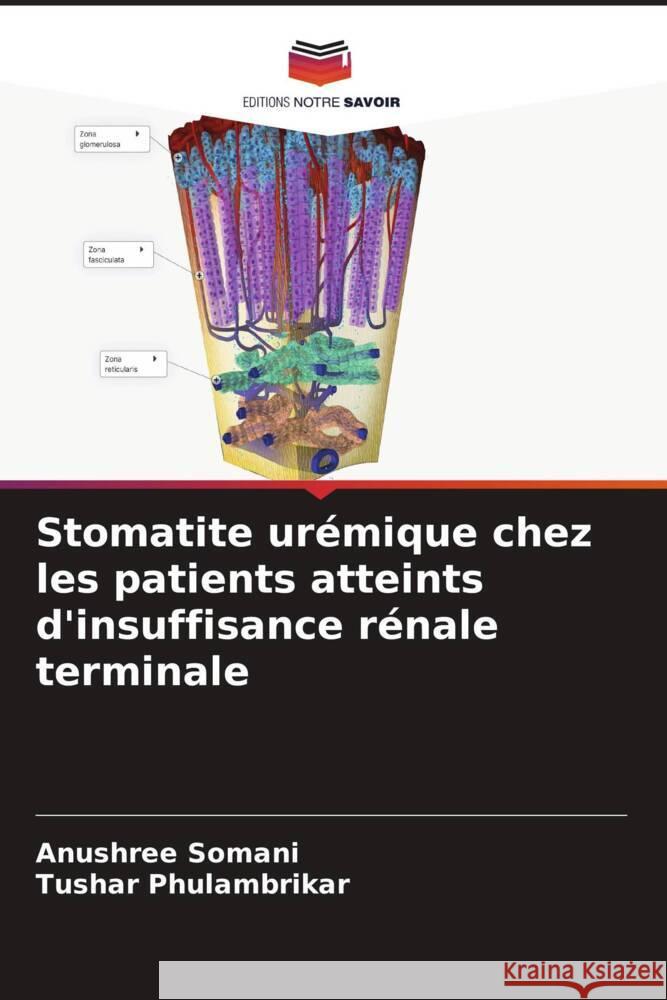 Stomatite ur?mique chez les patients atteints d'insuffisance r?nale terminale Anushree Somani Tushar Phulambrikar 9786207336883 Editions Notre Savoir - książka