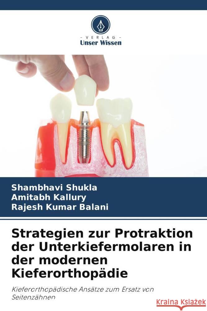 Strategien zur Protraktion der Unterkiefermolaren in der modernen Kieferorthopädie Shukla, Shambhavi, Kallury, Amitabh, Kumar Balani, Rajesh 9786208254919 Verlag Unser Wissen - książka