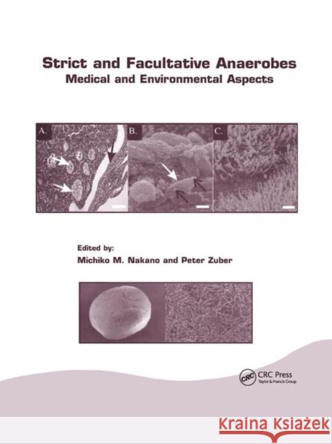 Strict and Facultative Anaerobes: Medical and Environmental Aspects Michiko M. Nakano Peter Zuber 9780367393755 CRC Press - książka