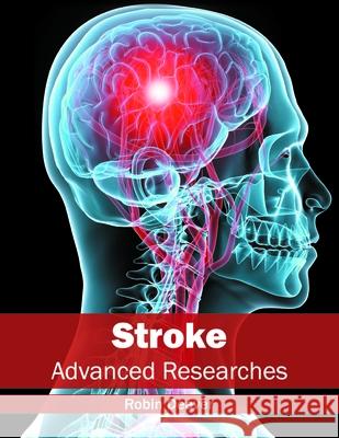 Stroke: Advanced Researches Robin Deaver 9781632413970 Hayle Medical - książka