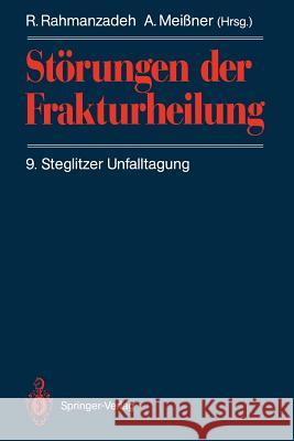 Störungen Der Frakturheilung: 9. Steglitzer Unfalltagung Rahmanzadeh, R. 9783540541462 Not Avail - książka