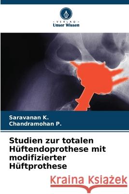 Studien zur totalen Hüftendoprothese mit modifizierter Hüftprothese K., Saravanan, P., Chandramohan 9786208778491 Verlag Unser Wissen - książka