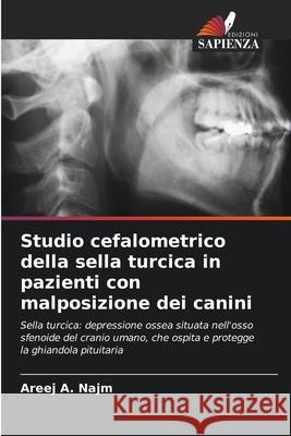 Studio cefalometrico della sella turcica in pazienti con malposizione dei canini A. Najm, Areej 9786208817473 Edizioni Sapienza - książka