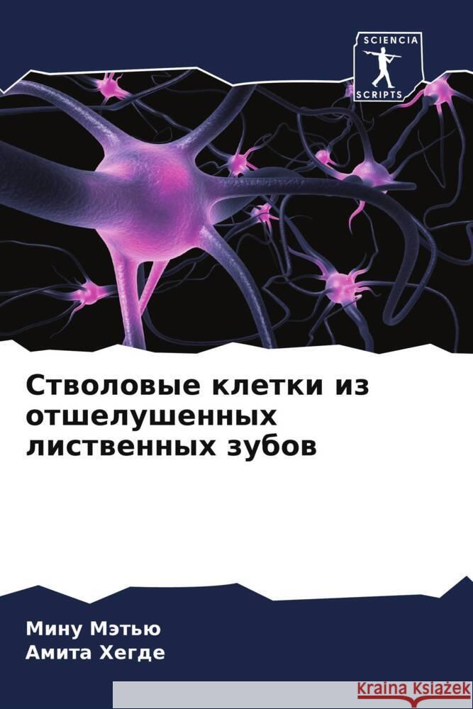 Stwolowye kletki iz otshelushennyh listwennyh zubow Mät'ü, Minu, Hegde, Amita 9786208380922 Sciencia Scripts - książka