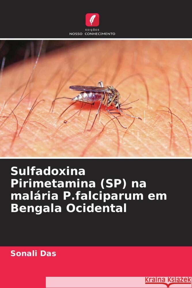 Sulfadoxina Pirimetamina (SP) na malária P.falciparum em Bengala Ocidental Das, Sonali 9786206438106 Edições Nosso Conhecimento - książka