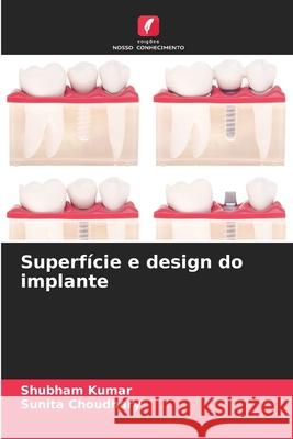 Superf?cie e design do implante Shubham Kumar Sunita Choudhary 9786207906840 Edicoes Nosso Conhecimento - książka