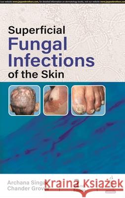 Superficial Fungal Infections of the Skin Archana Singhal, Chander Grover 9789356964426 Jaypee Brothers Medical Publishers - książka