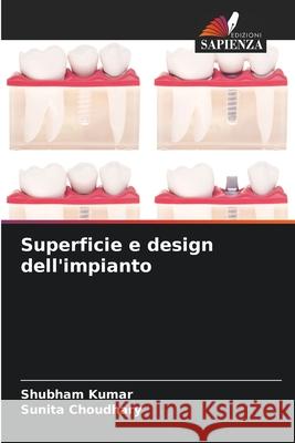 Superficie e design dell'impianto Shubham Kumar Sunita Choudhary 9786207906918 Edizioni Sapienza - książka