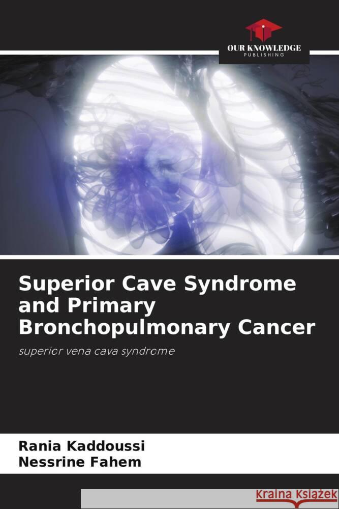 Superior Cave Syndrome and Primary Bronchopulmonary Cancer Rania Kaddoussi Nessrine Fahem 9786208102111 Our Knowledge Publishing - książka
