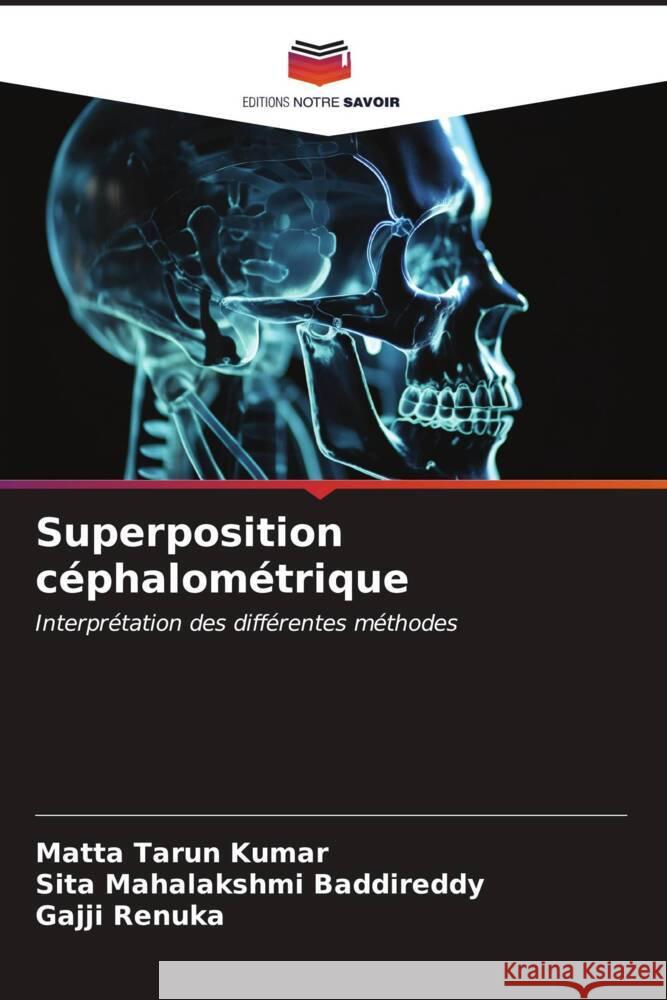 Superposition c?phalom?trique Matta Taru Sita Mahalakshmi Baddireddy Gajji Renuka 9786206634003 Editions Notre Savoir - książka