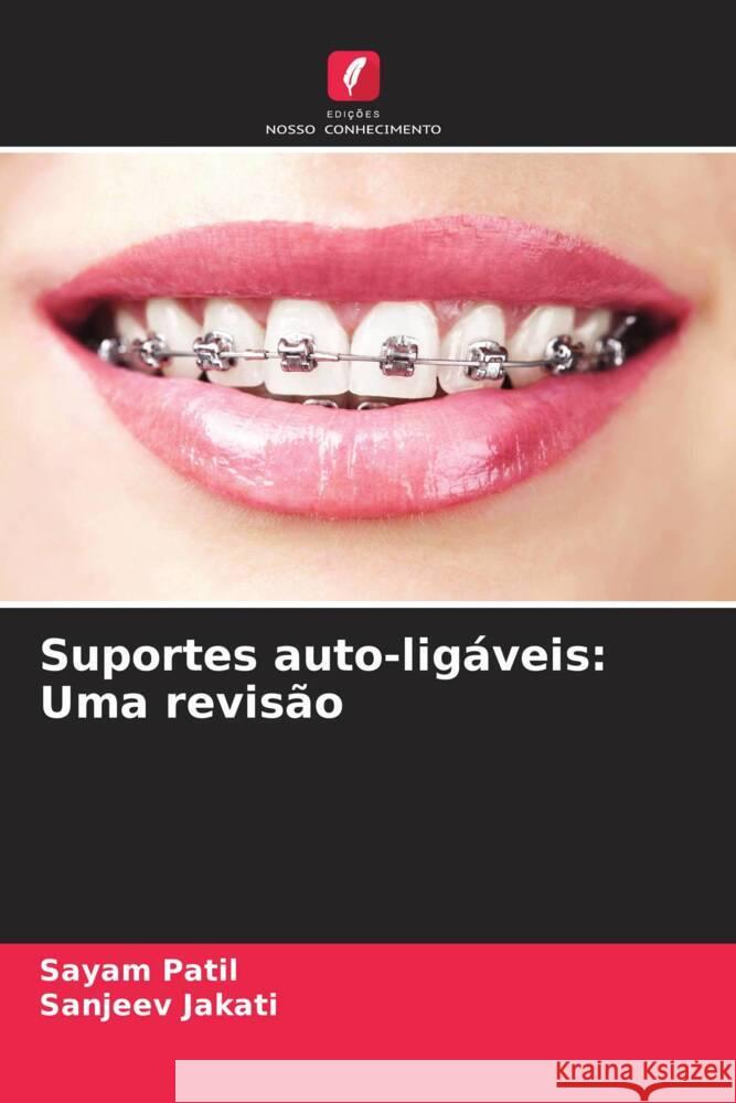 Suportes auto-lig?veis: Uma revis?o Sayam Patil Sanjeev Jakati 9786208020859 Edicoes Nosso Conhecimento - książka