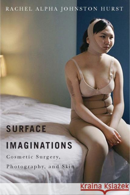 Surface Imaginations: Cosmetic Surgery, Photography, and Skin Rachel Alpha Johnston Hurst 9780773546004 McGill-Queen's University Press - książka