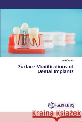 Surface Modifications of Dental Implants Verma, Ankit 9786202563437 LAP Lambert Academic Publishing - książka