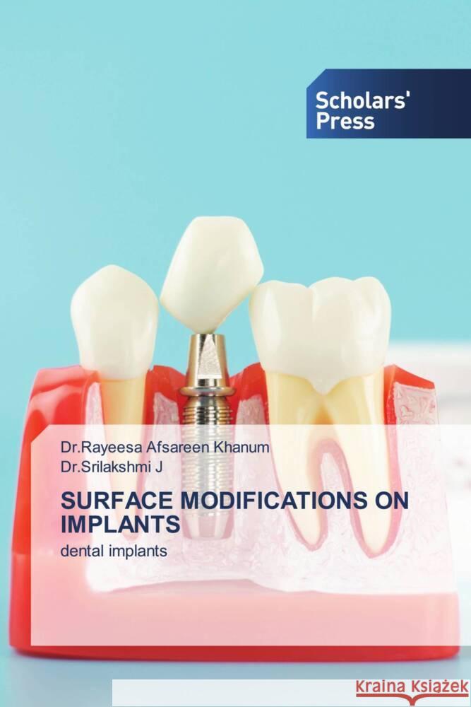 SURFACE MODIFICATIONS ON IMPLANTS Khanum, Dr.Rayeesa Afsareen, J, Dr.Srilakshmi 9786205524541 Scholars' Press - książka