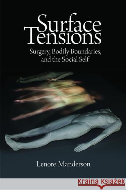 Surface Tensions: Surgery, Bodily Boundaries, and the Social Self Manderson, Lenore 9781611320978 Left Coast Press - książka