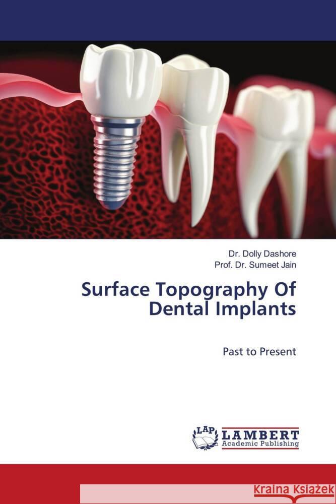 Surface Topography Of Dental Implants Dashore, Dr. Dolly, Jain, Prof. Dr. Sumeet 9786208421595 LAP Lambert Academic Publishing - książka