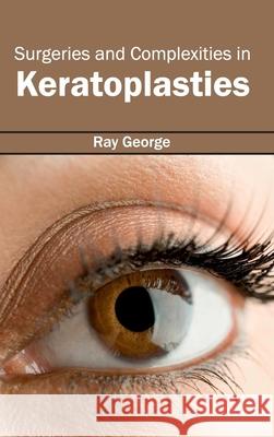 Surgeries and Complexities in Keratoplasties Ray George 9781632413628 Hayle Medical - książka