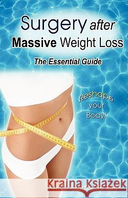 Surgery After Massive Weight Loss: The Essential Consumer Guide Dr Anire Okpak Logographica Marketing 9781451545555 Createspace - książka