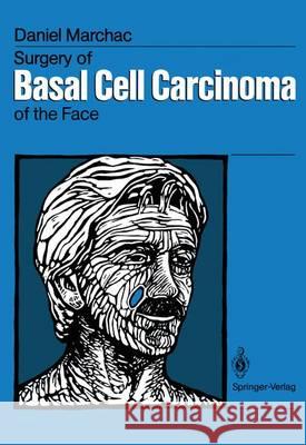 Surgery of Basal Cell Carcinoma of the Face Daniel Marchac Eric Pugash Claude Dufourmentel 9783642728136 Springer - książka