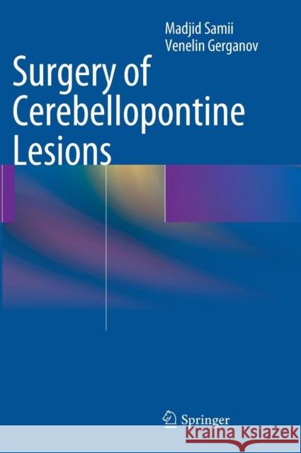 Surgery of Cerebellopontine Lesions Madjid Samii 9783642354212 Springer, Berlin - książka