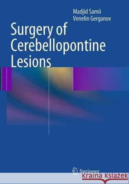 Surgery of Cerebellopontine Lesions Madjid Samii Venelin Gerganov 9783662521014 Springer - książka