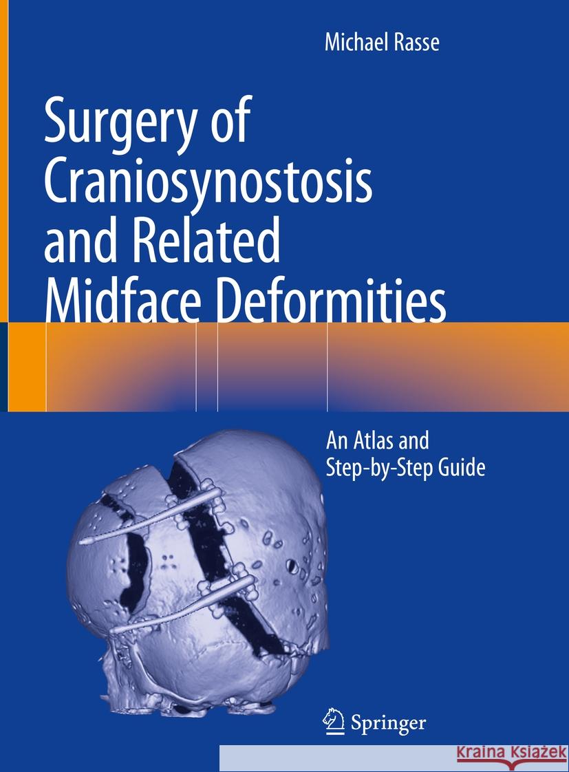 Surgery of Craniosynostosis and Related Midface Deformities: An Atlas and Step-By-Step Guide Michael Rasse 9783031491016 Springer - książka