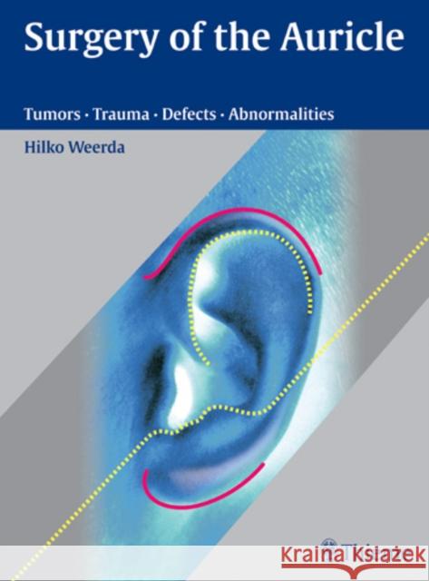 Surgery of the Auricle: Tumors-Trauma-Defects-Abnormalities Weerda, Hilko 9783131394118 Thieme Publishing Group - książka
