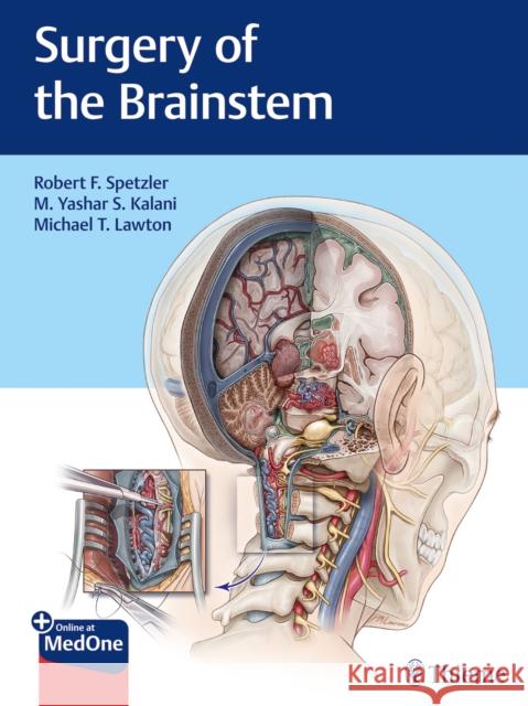 Surgery of the Brainstem Robert F. Spetzler M. Yashar S. Kalani 9781626232914 Thieme Medical Publishers - książka