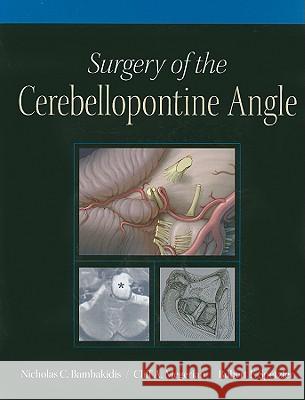 Surgery of the Cerebellopontine Angle [With DVD] Bambakidis, Nicholas C. 9781607950011 People's Medical Publishing House - książka