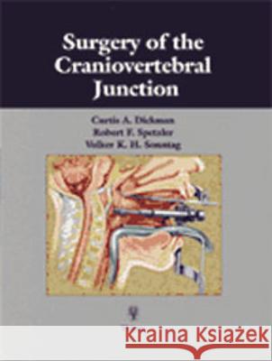 Surgery of the Craniovertebral Junction Curtis Dickman Volker Sonntag Robert F. Spetzler 9780865776814 Thieme Medical Publishers - książka