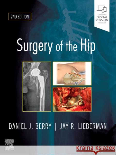 Surgery of the Hip Daniel J. Berry Jay Lieberman 9780323554640 Elsevier - książka