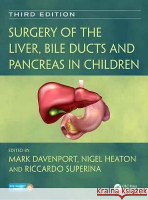 Surgery of the Liver, Bile Ducts and Pancreas in Children Mark Mark Nigel Nigel Rik Rik 9781444181203 CRC Press - książka