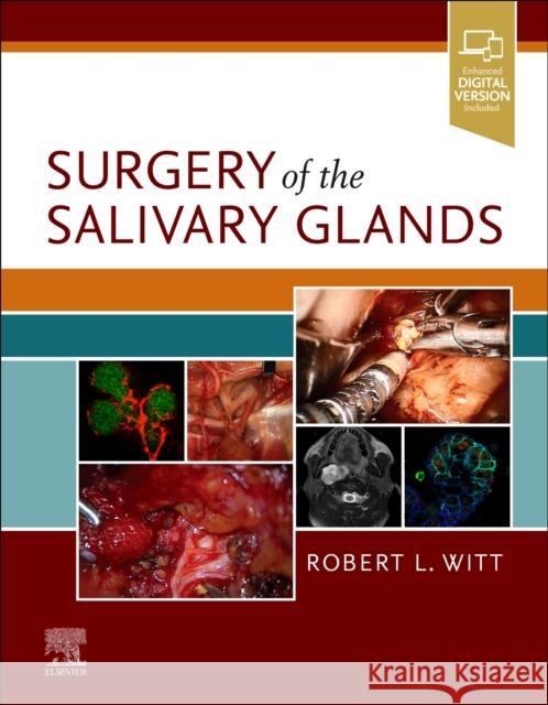 Surgery of the Salivary Glands Robert L. Witt 9780323672368 Elsevier - książka